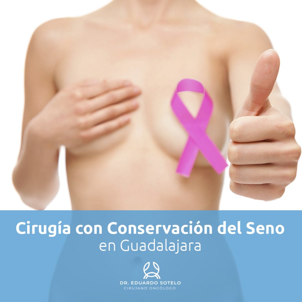 cirugía con conservación del seno en Guadalajara